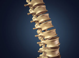 Spinal Implants for Critical Surgeries