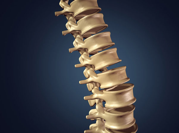 Spinal Implants for Critical Surgeries